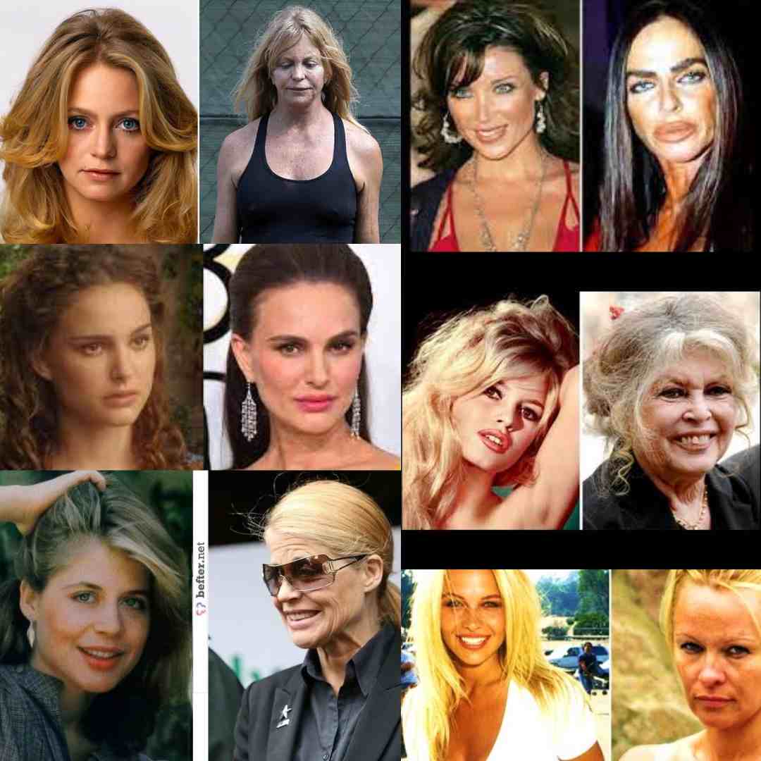 Podemos observar los efectos de la edad en las chicas cuando pasan el llamado muro.